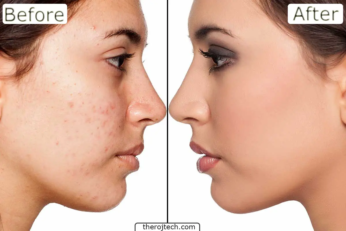 skincare before and after